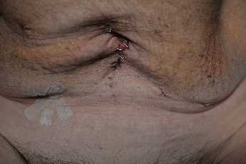 Click to see 35 July 4th Scars.JPG